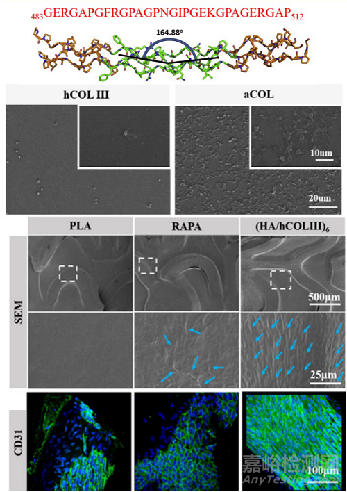 心血管疾病治療的創(chuàng)新生物材料和器械取得新進(jìn)展