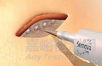 Cell Pouch：潛在糖尿病治愈技術 無需注射胰島素