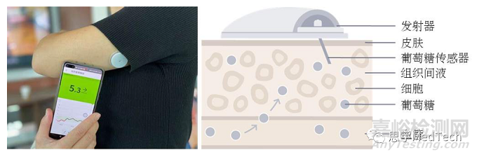 連續(xù)血糖監(jiān)測(cè)(CGM)技術(shù)發(fā)展與市場(chǎng)分析