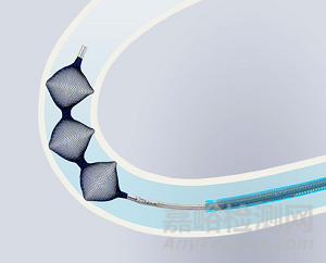 LOBO：FDA批準(zhǔn)大號(hào)血管封堵器