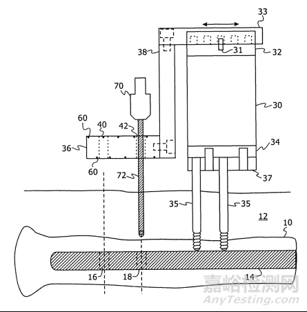 Mazor手術(shù)機器人技術(shù)與專利分析