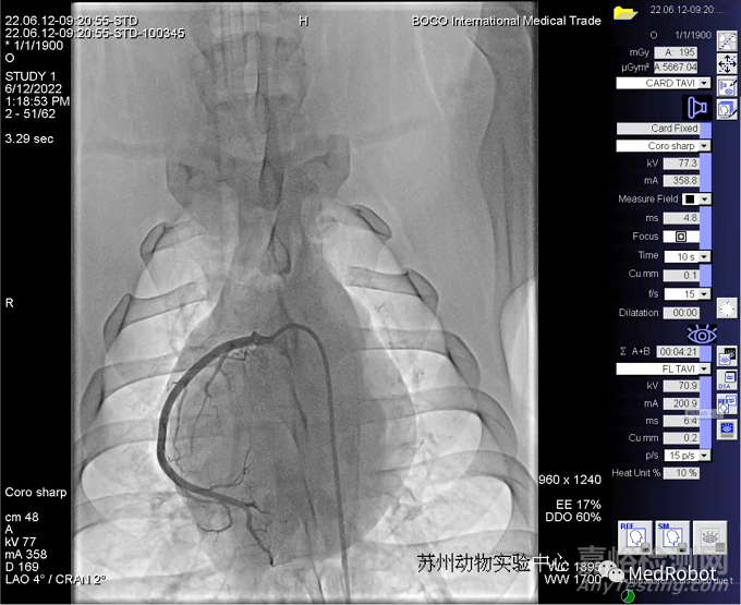 微亞醫(yī)療完成國(guó)內(nèi)首例異地遠(yuǎn)程冠脈介入動(dòng)物實(shí)驗(yàn)