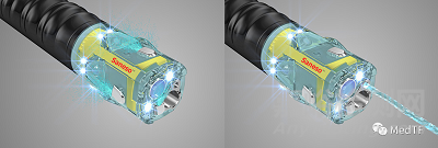 Saneso 360°：360°視野的消化內(nèi)鏡 顛覆奧林巴斯