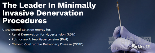 TIVUS:超聲消融RDN產(chǎn)品獲FDA批準(zhǔn)進(jìn)行IDE研究