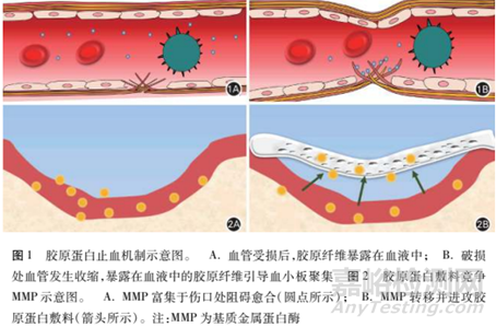 骨缺損、牙科、肌腱損傷等敷料領(lǐng)域的最新研究進(jìn)展