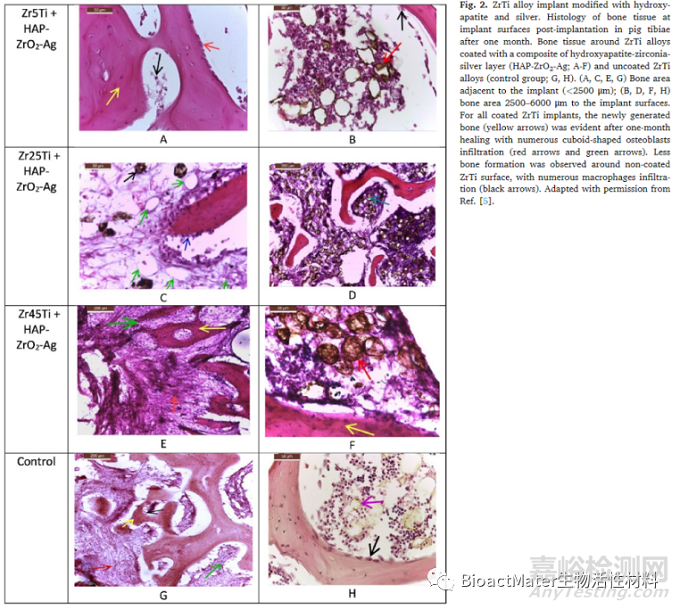 先進(jìn)牙科種植體：具有生物活性和治療性的氧化鋯種植體