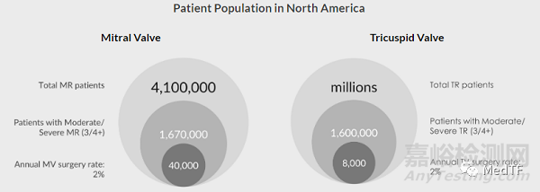 CryoCinch：冷凍定位的瓣環(huán)修復(fù) 治療MR和TR