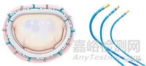 CryoCinch：冷凍定位的瓣環(huán)修復(fù) 治療MR和TR
