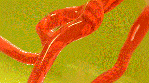 ECMIS ：電磁可控微型介入機器人