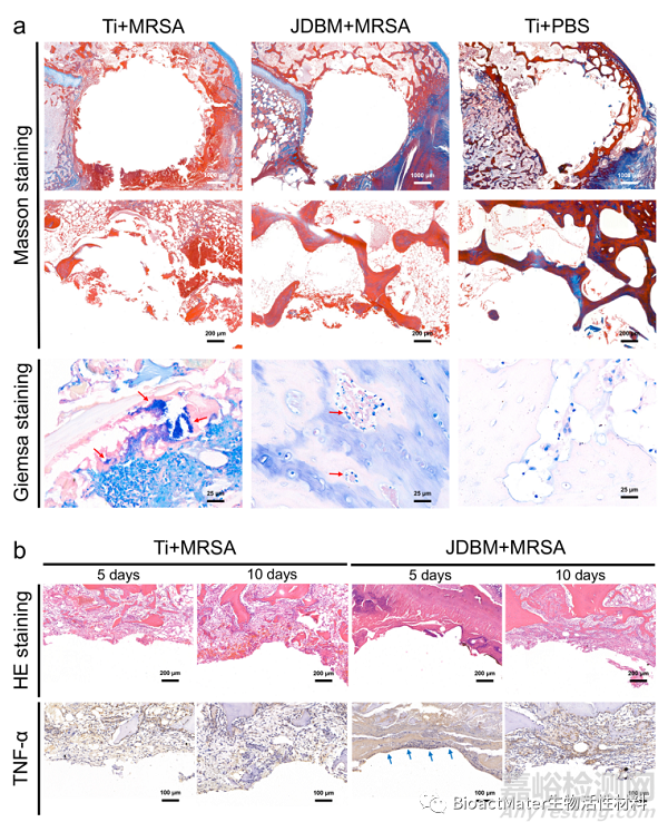 3D打印Mg-Nd-Zn-Zr鎂合金植入物治療骨感染的實驗研究
