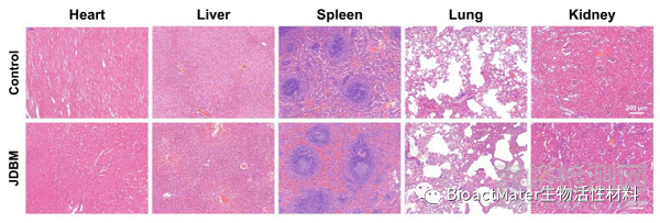3D打印Mg-Nd-Zn-Zr鎂合金植入物治療骨感染的實驗研究