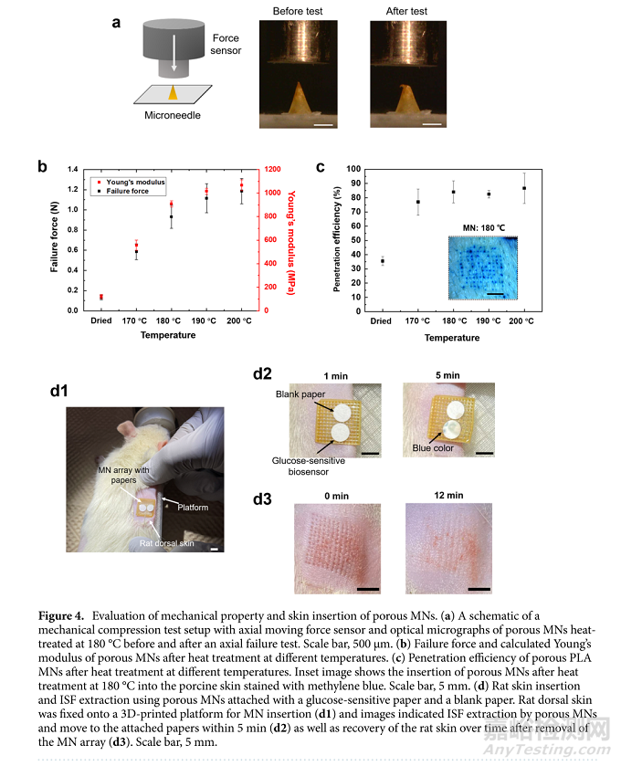 植入式新型貼片傳感器的設(shè)計(jì)及其參數(shù)
