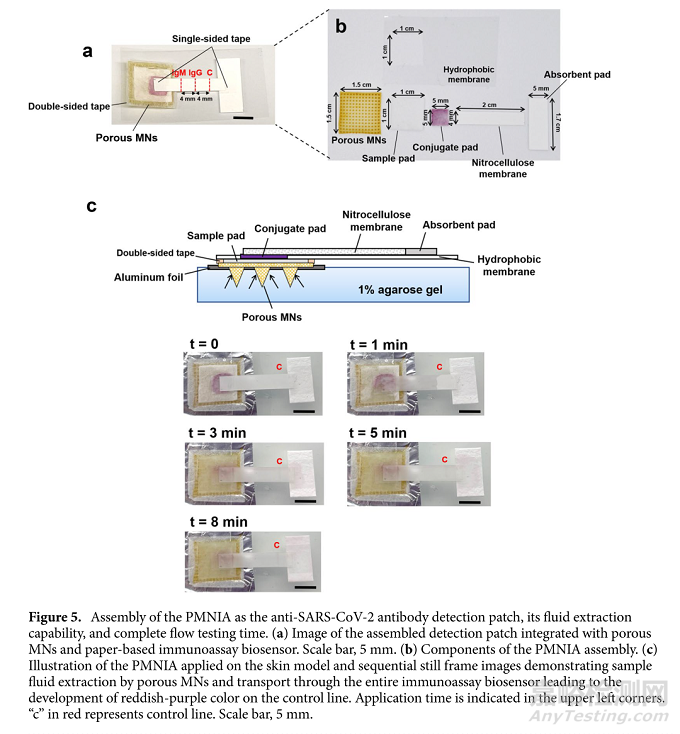 植入式新型貼片傳感器的設(shè)計(jì)及其參數(shù)