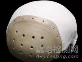 PEEK在3D打印醫(yī)療領域的應用