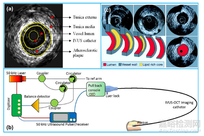 血管內(nèi)超聲（IVUS）的器械構(gòu)成及技術(shù)趨勢