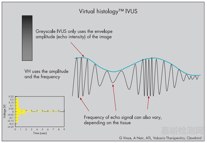 血管內(nèi)超聲（IVUS）的器械構(gòu)成及技術(shù)趨勢