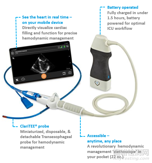 Zura:首款手持式經(jīng)食管超聲心動圖