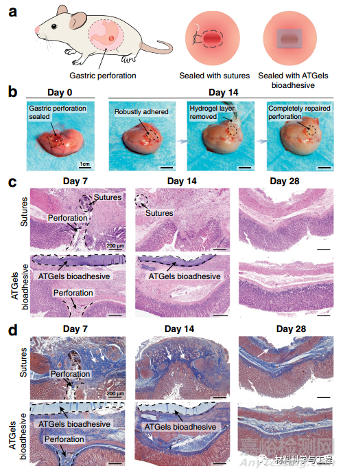 可用于胃穿孔修復(fù)的極強耐酸性水凝膠生物粘附劑