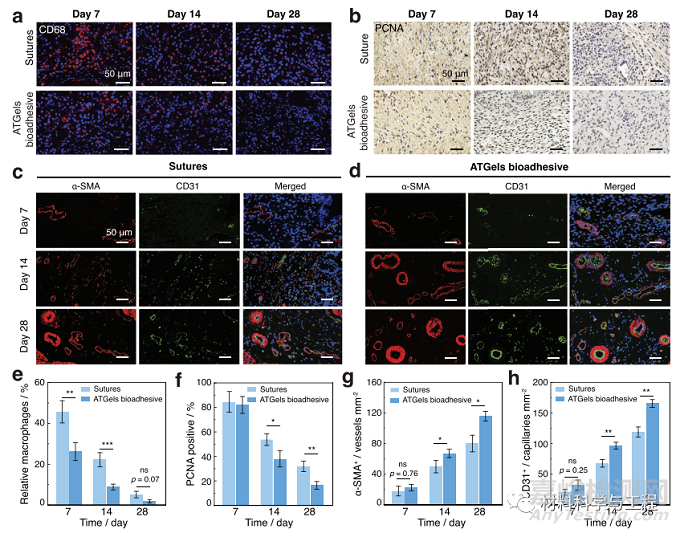 可用于胃穿孔修復(fù)的極強耐酸性水凝膠生物粘附劑