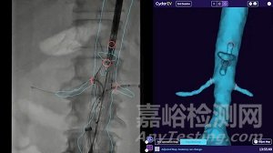 C型臂全球市場(chǎng)動(dòng)態(tài)