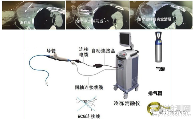 冷凍消融市場、產(chǎn)品和公司盤點(diǎn)