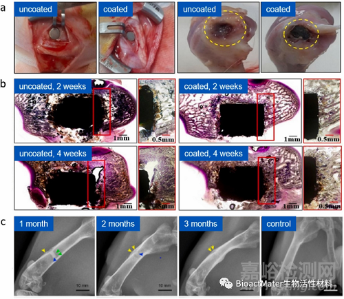 頗具潛力的生物活性涂層系統(tǒng)—用于高性能可吸收鎂質(zhì)骨植入物