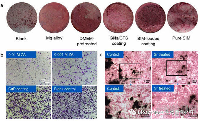 頗具潛力的生物活性涂層系統(tǒng)—用于高性能可吸收鎂質(zhì)骨植入物