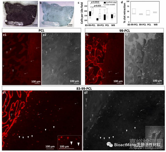 利用殼聚糖涂層的自身免疫活性促進(jìn)帶孔聚己內(nèi)酯支架中血管、骨和軟骨的生成