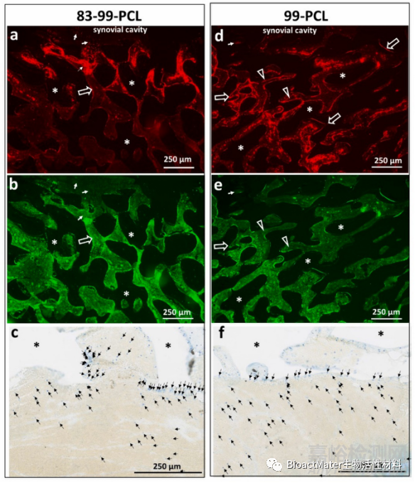 利用殼聚糖涂層的自身免疫活性促進(jìn)帶孔聚己內(nèi)酯支架中血管、骨和軟骨的生成