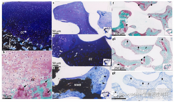 利用殼聚糖涂層的自身免疫活性促進(jìn)帶孔聚己內(nèi)酯支架中血管、骨和軟骨的生成