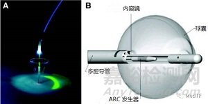 HeartLight PFA:帶有內(nèi)窺鏡功能的高順應(yīng)性PFA