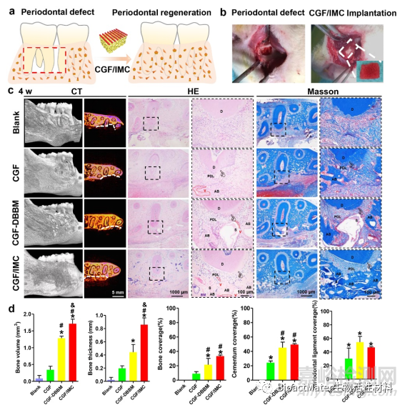 構(gòu)建仿生牙周有序雙層納米結(jié)構(gòu)的支架材料