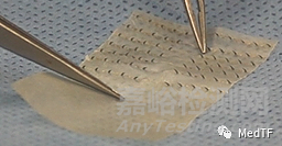 NERVE TAPE：首個(gè)免縫合神經(jīng)修復(fù)“膠帶”獲FDA批準(zhǔn)上市