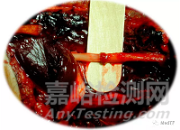 NERVE TAPE：首個(gè)免縫合神經(jīng)修復(fù)“膠帶”獲FDA批準(zhǔn)上市