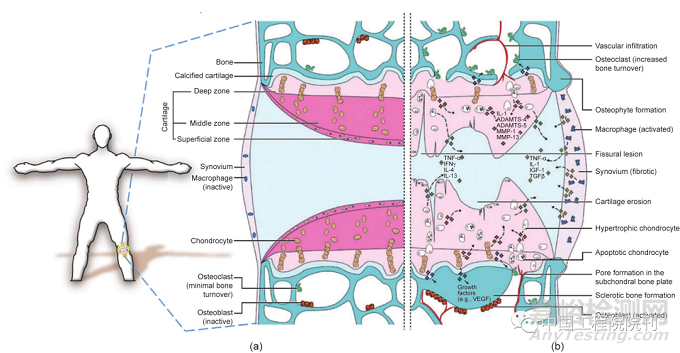 膝關(guān)節(jié)骨性關(guān)節(jié)炎治療的再生工程