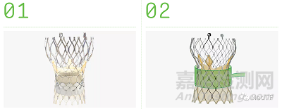ShortCut：有效預(yù)防TAVR術(shù)引發(fā)冠狀動(dòng)脈閉塞
