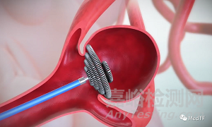 NAUTILUS：類“龍旋風(fēng)”的彈簧圈 重建寬頸動(dòng)脈瘤