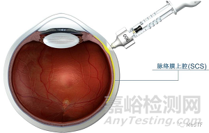 Prix Galien：2021年最具創(chuàng)新性的24個醫(yī)療器械