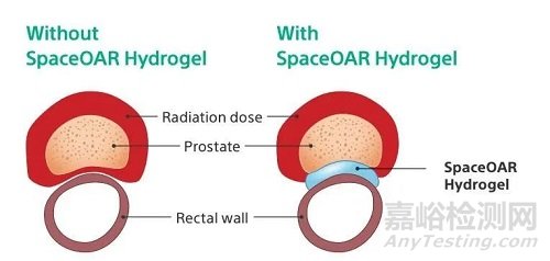 Prix Galien：2021年最具創(chuàng)新性的24個醫(yī)療器械