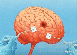 Prix Galien：2021年最具創(chuàng)新性的24個醫(yī)療器械