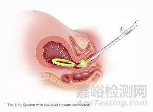 Prix Galien：2021年最具創(chuàng)新性的24個醫(yī)療器械