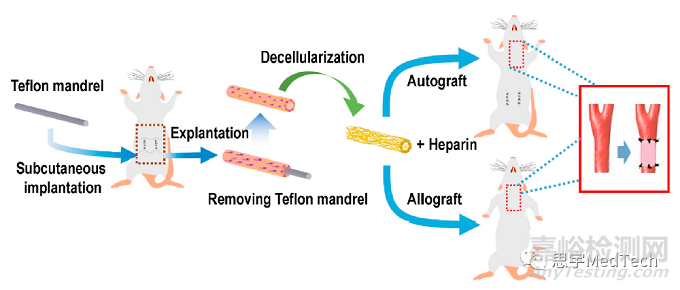 冠脈支架的發(fā)展歷史、產(chǎn)品創(chuàng)新思路與國產(chǎn)代表產(chǎn)品