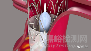 Aortoseal :具有縫合功能的EVAR覆膜支架