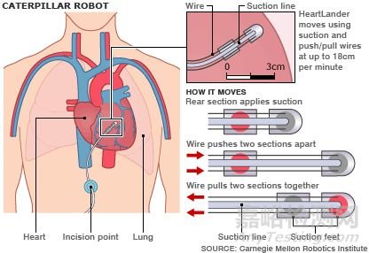 Heartlander Robot：心外科爬行機(jī)器人 簡(jiǎn)化手術(shù)