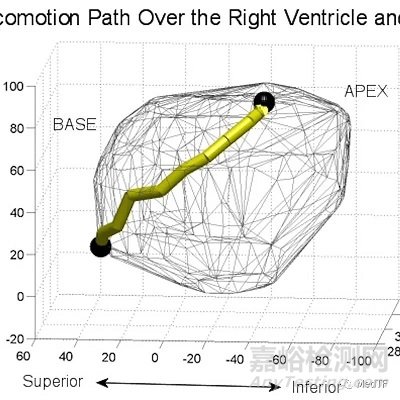Heartlander Robot：心外科爬行機(jī)器人 簡(jiǎn)化手術(shù)
