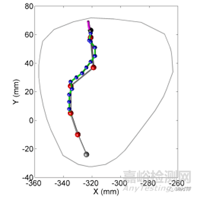 Heartlander Robot：心外科爬行機(jī)器人 簡(jiǎn)化手術(shù)