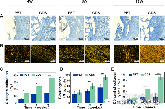 具有動(dòng)態(tài)力學(xué)性能和空間適配性的再生過程匹配支架用于韌帶重建