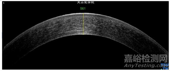 準(zhǔn)分子激光角膜屈光治療儀臨床試驗(yàn)設(shè)計(jì)思路