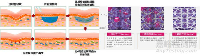 再生類注射劑的功效、制備工藝、代表產(chǎn)品