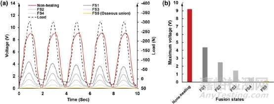 用于監(jiān)測骨愈合進展的患者個性化自供能復合材料植入物